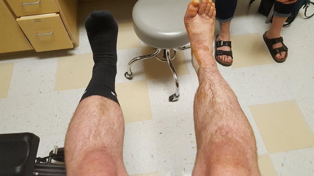 20170602_111431.thumb.jpg.b7ef3f1b367e5417760ba4d52e487559.jpg