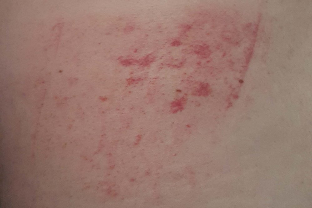 5aa4c2c89e813_backwound.thumb.jpg.235ed5a5410571368f621cb573fa5230.jpg