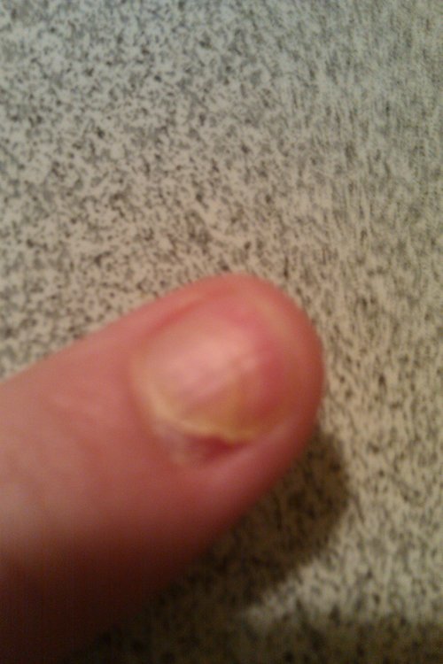 mynail.thumb.jpg.467307762694d64995c35e5cdefe3971.jpg